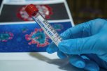 113 заболевших пополнили статистику коронавируса в Амурской области