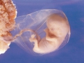 Ребенок в утробе — такой же живой человечек, как все мы, только его жизнь всецело зависит от мамы.