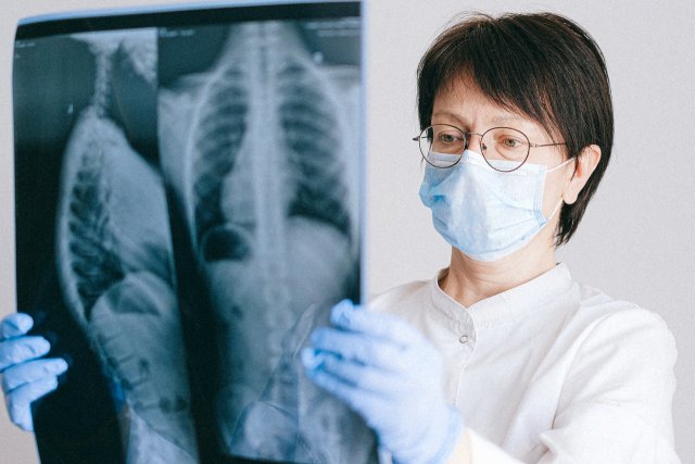 业务总部:在阿穆尔河地区,COVID-19的发病率没有下降的趋势/在阿穆尔河地区的一周中,登记的36例冠状病毒感染病例少于前一例。但是专家认为,没有任何动态来稳定和减少发病率。在过去的7天中,在该年度的第47周,该地区注册了1,124例COVID-2019案例(相比之下,第46周为1,160例)。