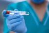 Благовещенск и Свободный в лидерах по COVID-2019: в области 1025 заболевших за неделю