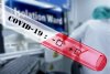 Большая часть с ОРВИ: в Амурской области 111 новых заболевших COVID-19