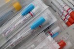 В Амурской области еще 12 человек заболели коронавирусом