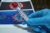 113 заболевших пополнили статистику коронавируса в Амурской области