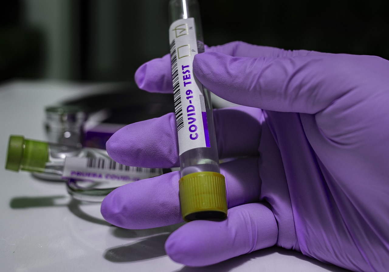 Статистика COVID-19 в Приамурье: 322 человека заболели и 82 — в больнице / За сутки в Амурской области выявили 322 новых случая COVID-2019, сообщает сайт стопкоронавирус.рф. Выздоровели после болезни 1 449 человек. 