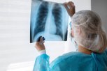 В Амурской области растет заболеваемость туберкулезом