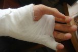 Жительница Завитинска обратилась за медицинской помощью после попытки погладить собаку на улице