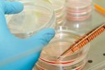 У подхвативших кишечную инфекцию благовещенских школьников обнаружен норовирус