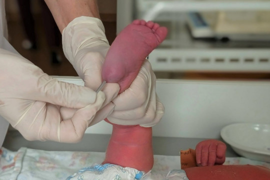 неонатальный скрининг генетические заболевания